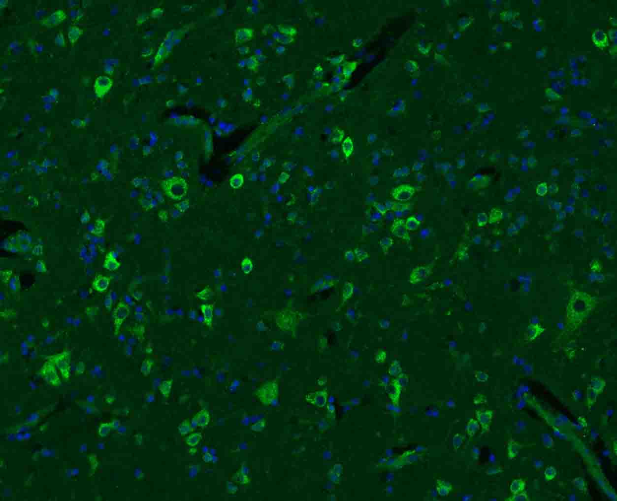 SGCB Rabbit pAb(bs-1127R)-50ul