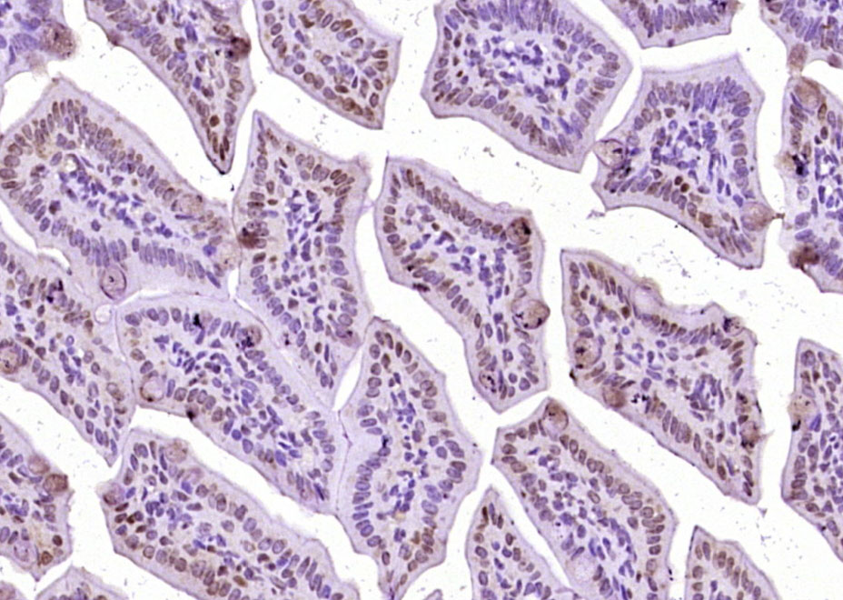phospho-Beta catenin (Ser33 + 