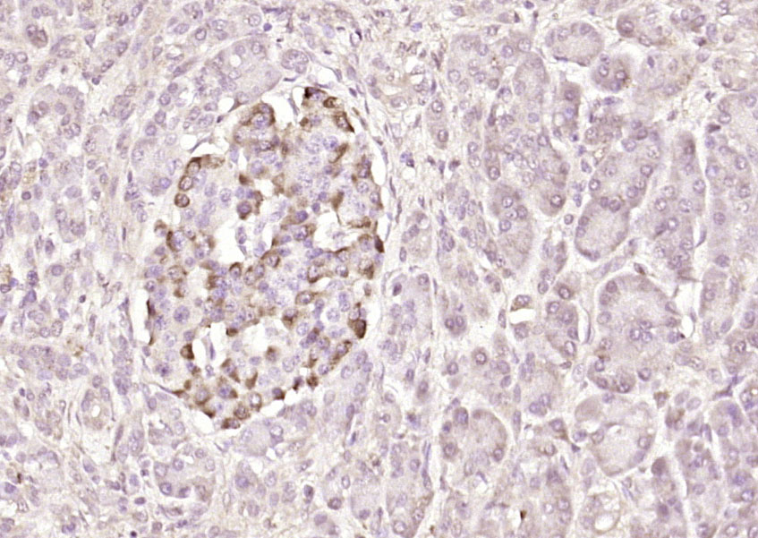 PIK3R5 Rabbit pAb(bs-7467R)-50