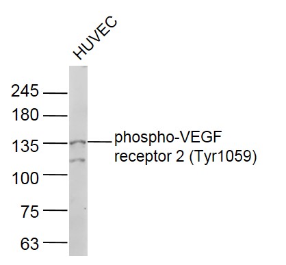 phospho-VEGF receptor 2 (Tyr10