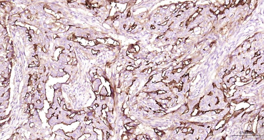 ICAM1 Rabbit pAb(bs-0608R)-50u