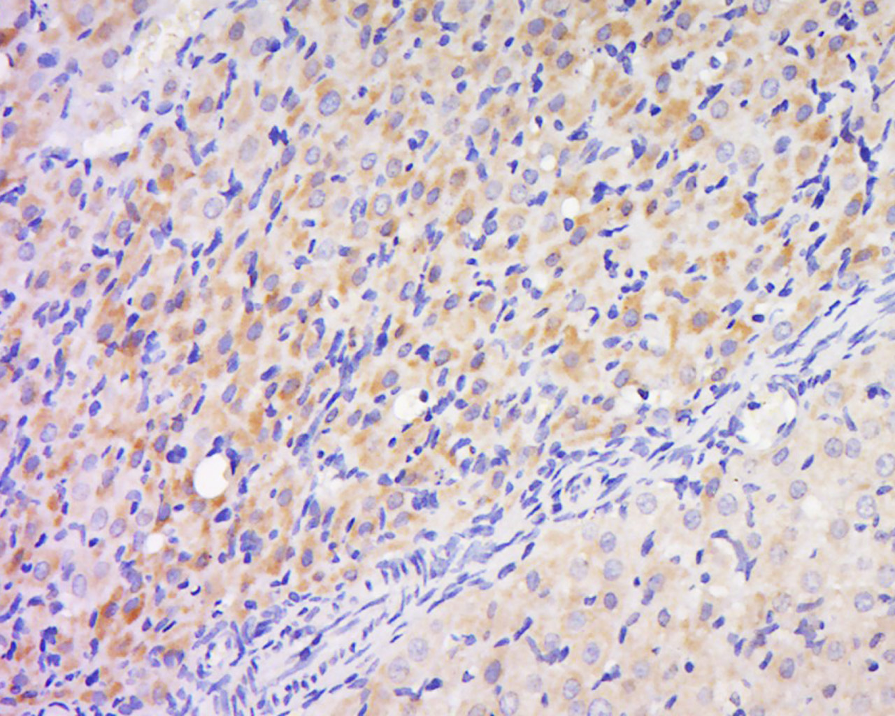 phospho-PAK2 (Ser141) Rabbit p