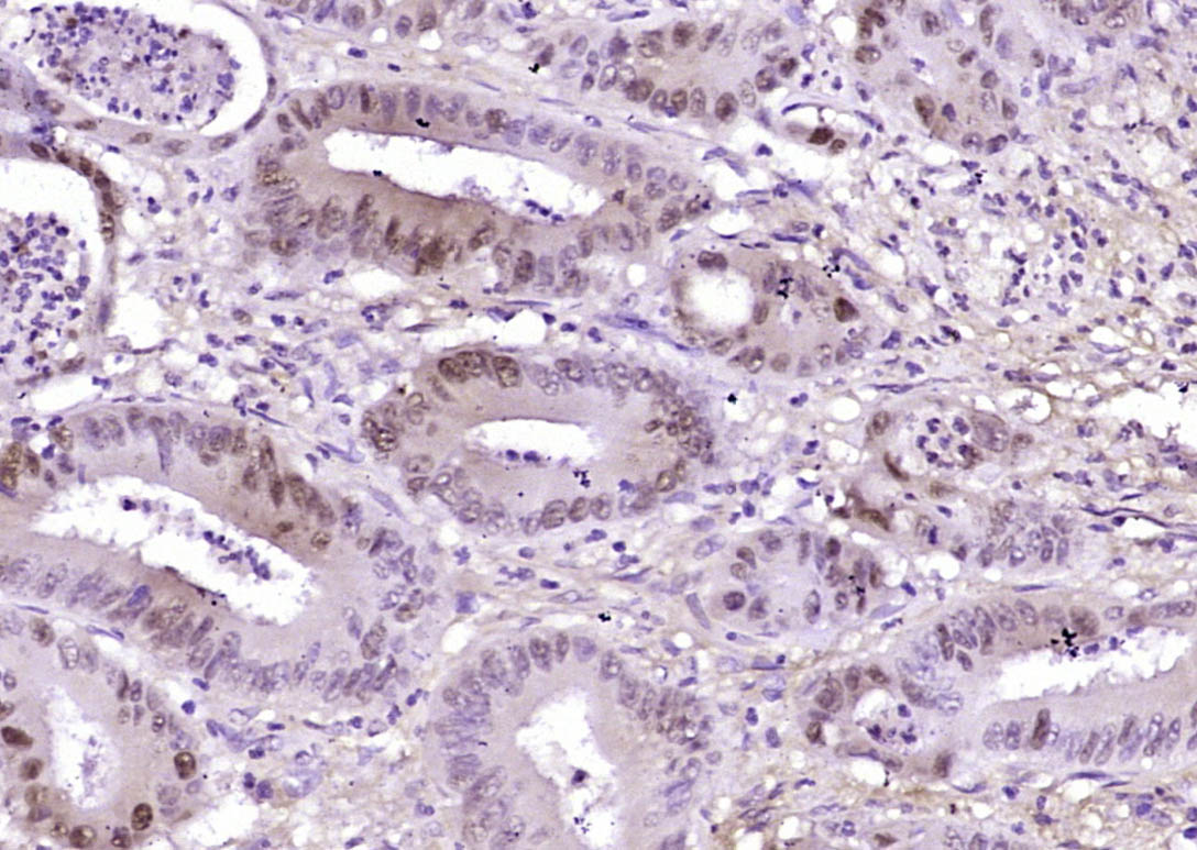 phospho-Beta catenin (Ser33 + 