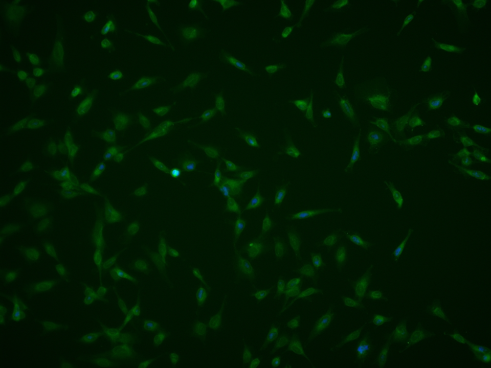 IFNAR1 Rabbit pAb(bs-4116R)-50