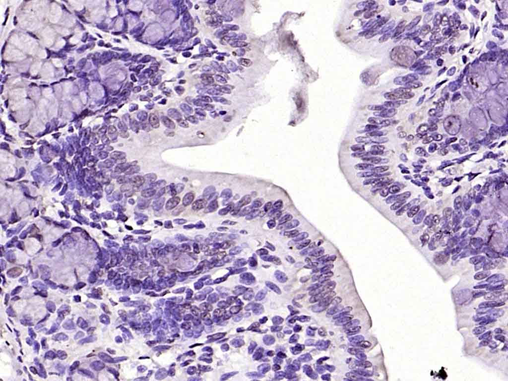 HDAC1 Rabbit pAb(bs-2895R)-50u
