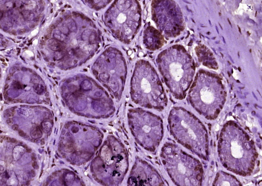 phospho-Beta catenin (Ser45) R