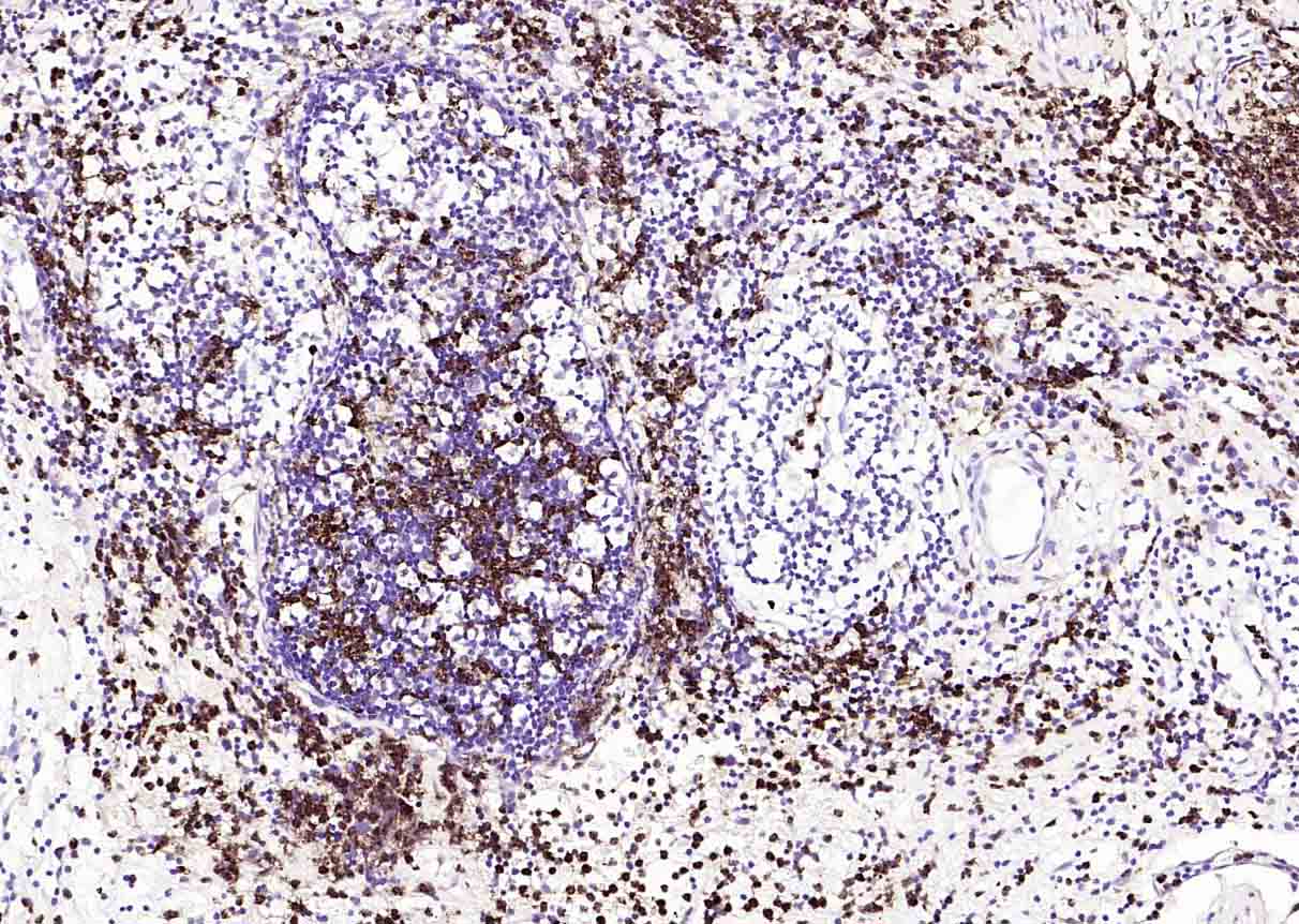 CEACAM5 Mouse mAb(bsm-43141M)-