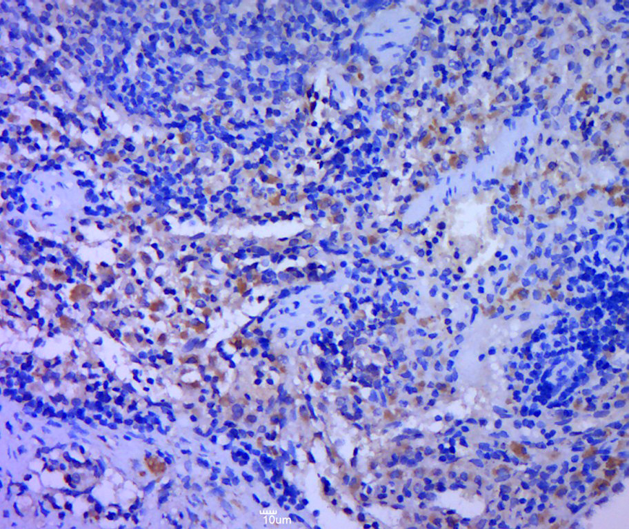 TLR6 Rabbit pAb(bs-2716R)-50ul