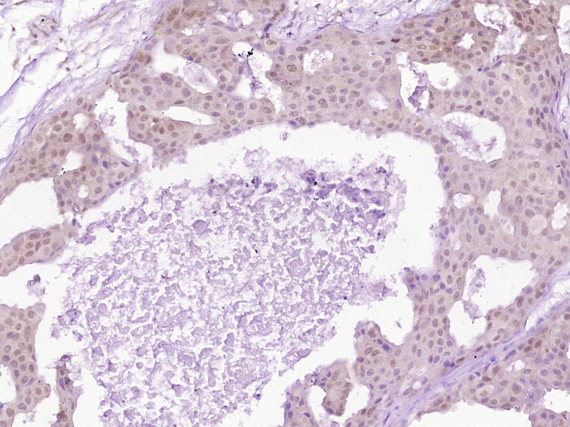 S100A4 Rabbit pAb(bs-3759R)-50