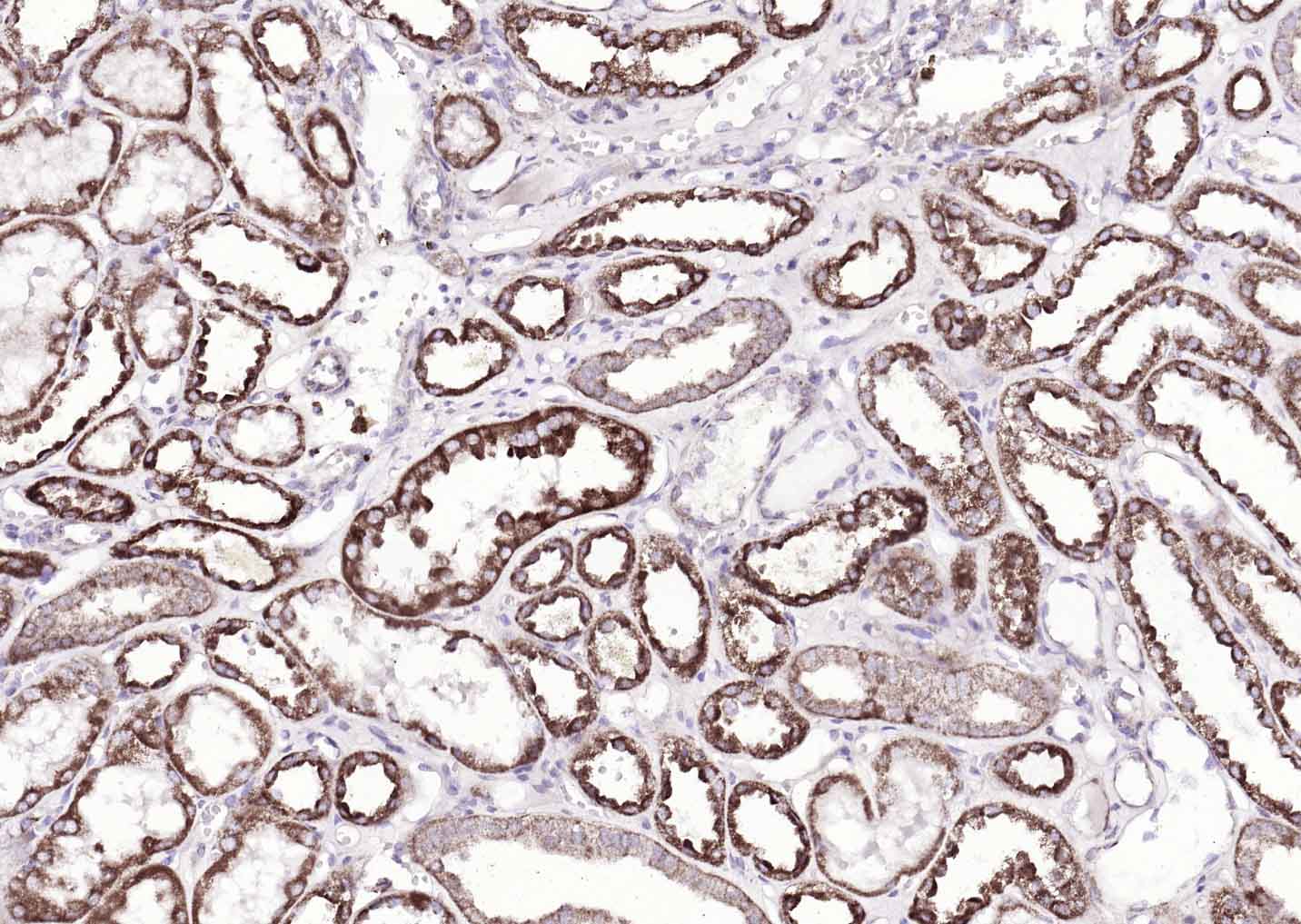 ATP7B Rabbit pAb(bs-1718R)-50u