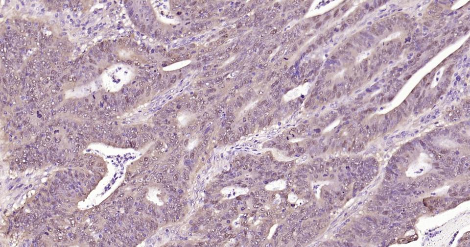 SNAI1 Rabbit pAb(bs-1371R)-50u