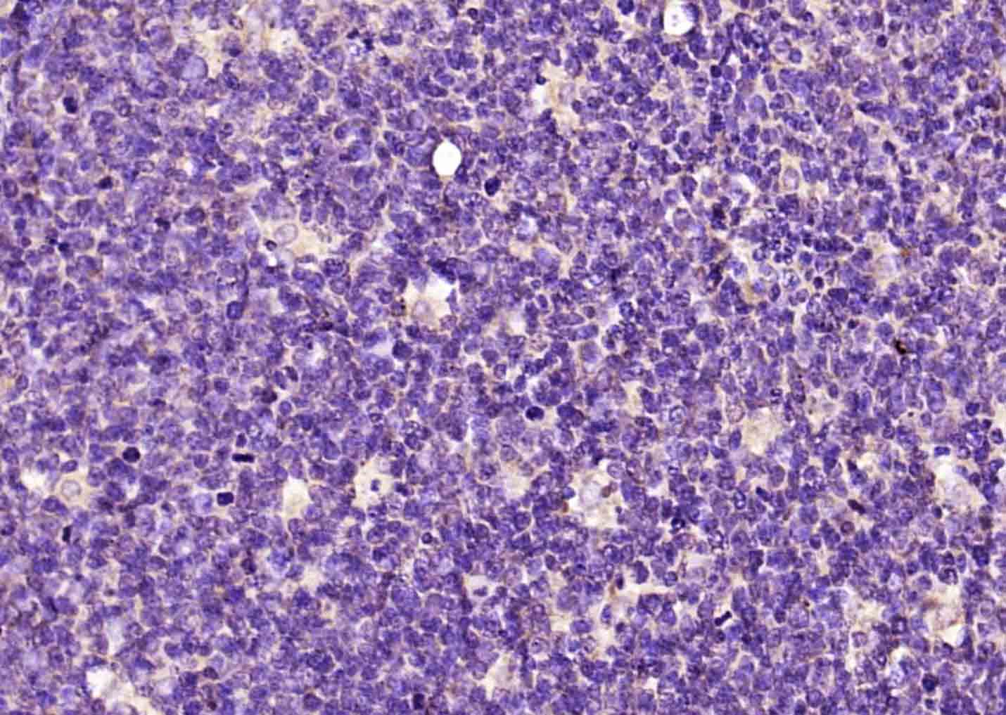 phospho-Bcl-2 (Ser70) Rabbit p