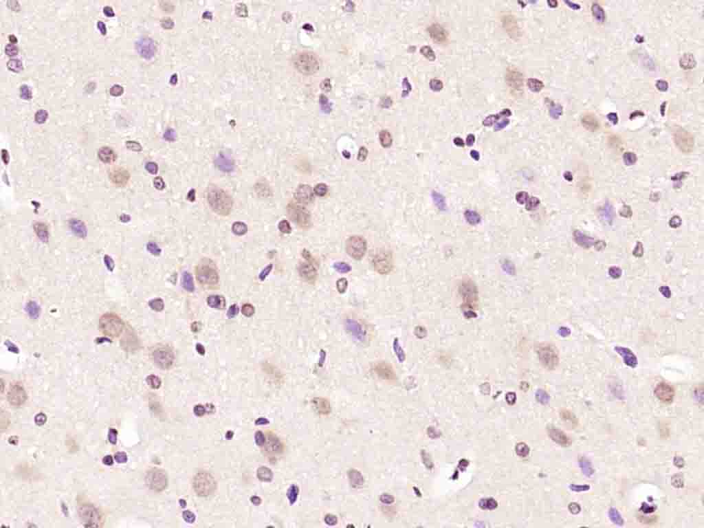 FAR2 Rabbit pAb(bs-10256R)-50u