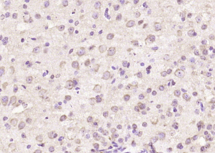 TRIM41 Rabbit pAb(bs-9151R)-50