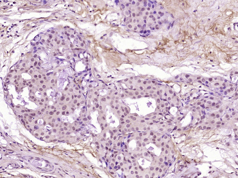 SOX11 Rabbit pAb(bs-6736R)-50u