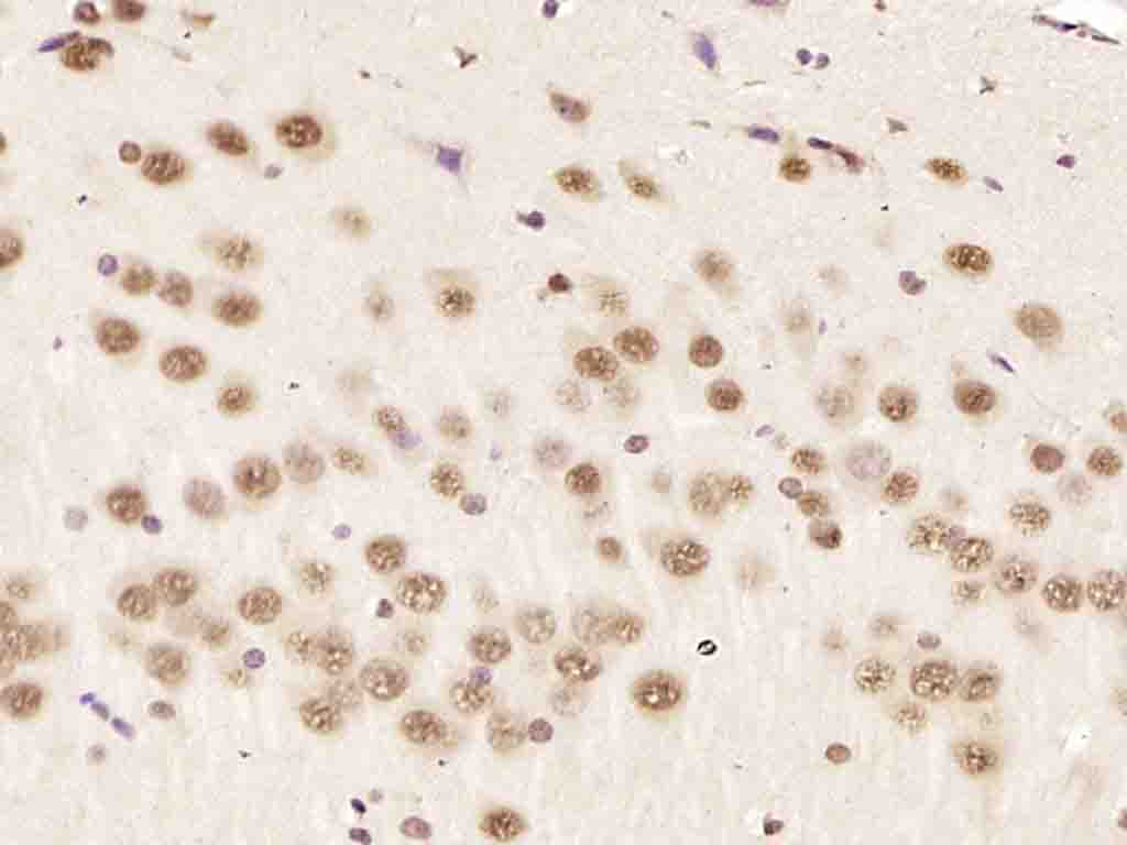 hnRNP K Rabbit pAb(bs-4296R)-5