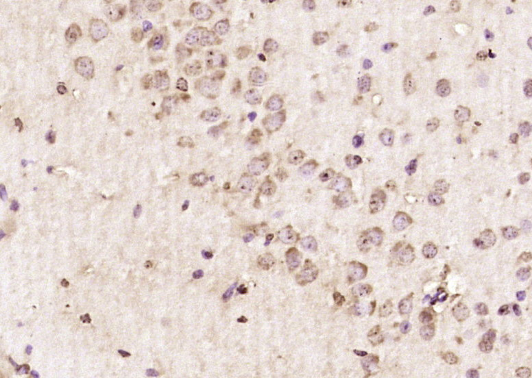 ABI2 Rabbit pAb(bs-5984R)-50ul