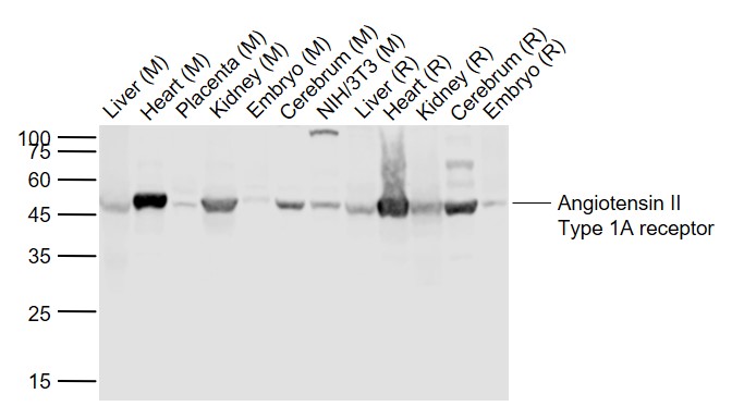 Angiotensin II type 1A recepto