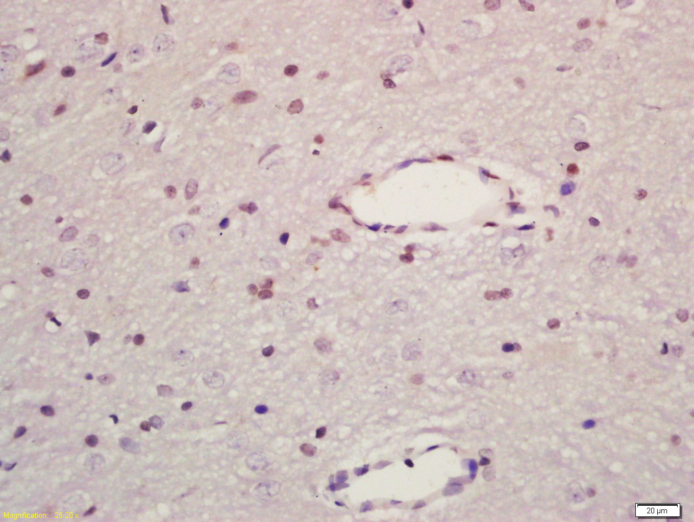 JIP1/MAPK8IP1 Rabbit pAb(bs-62