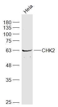 CHEK2 Rabbit pAb(bs-1391R)-50u