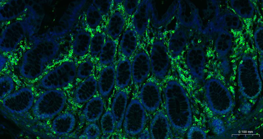 CD44 Recombinant Rabbit mAb(bs