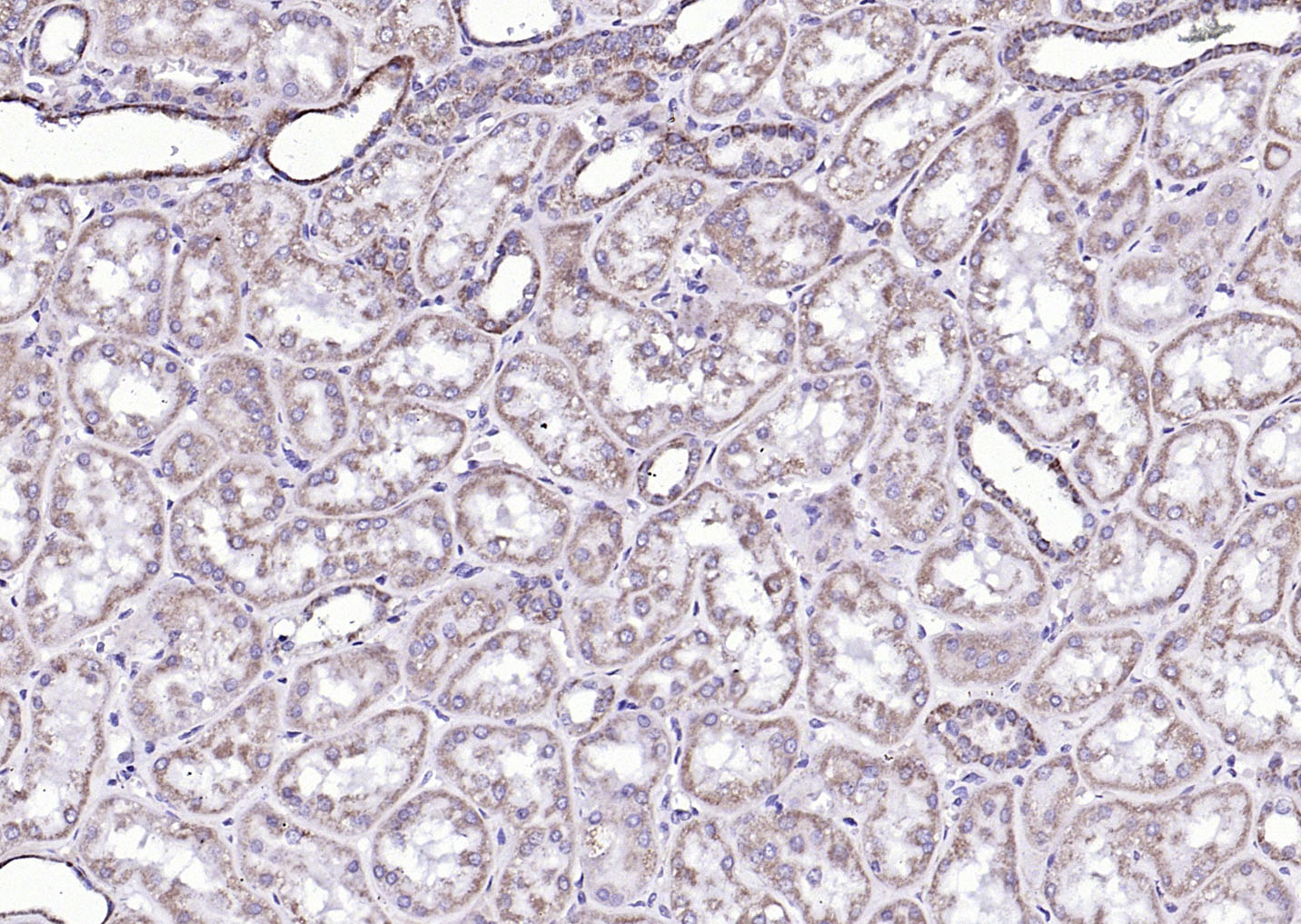 phospho-Bad (Ser134) Rabbit pA