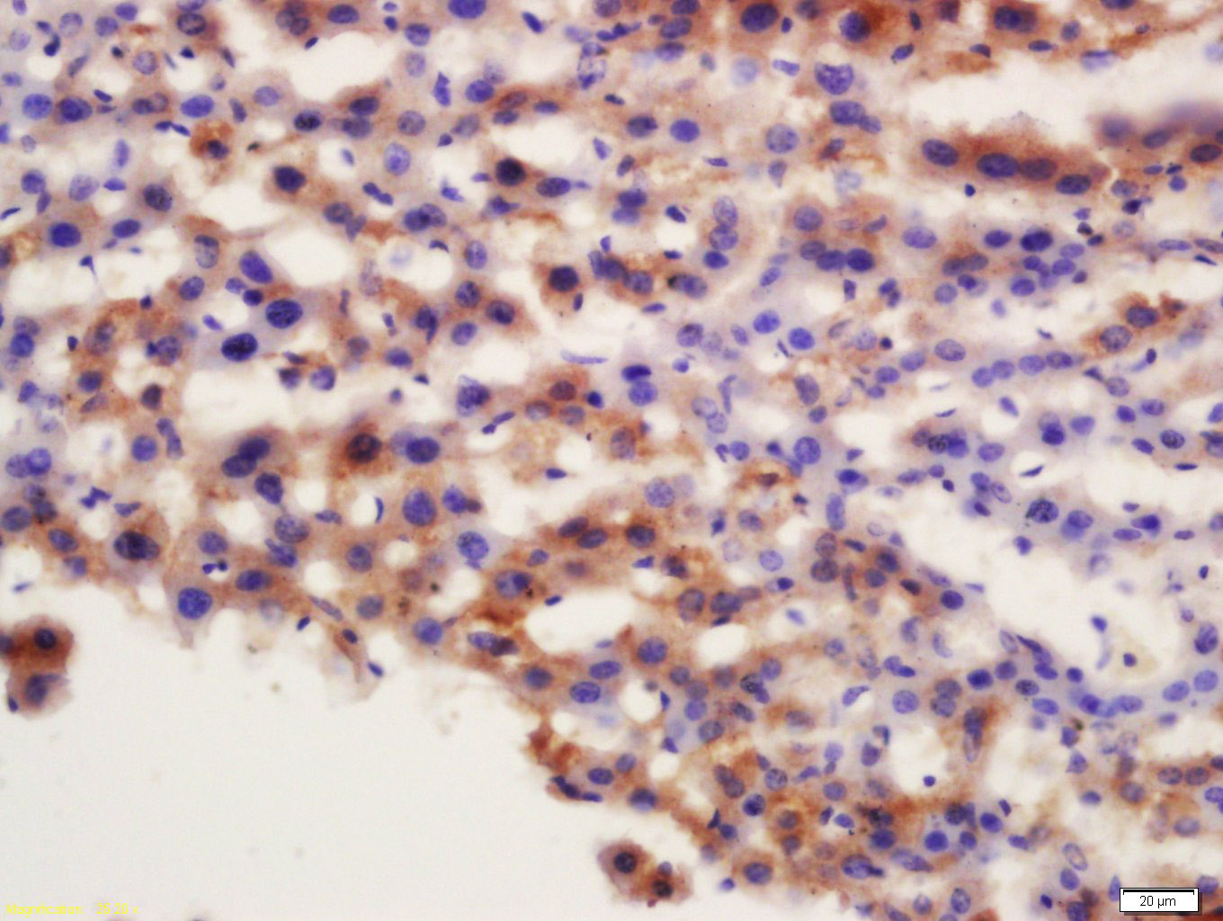 ATG7/APG7 Rabbit pAb(bs-2432R)