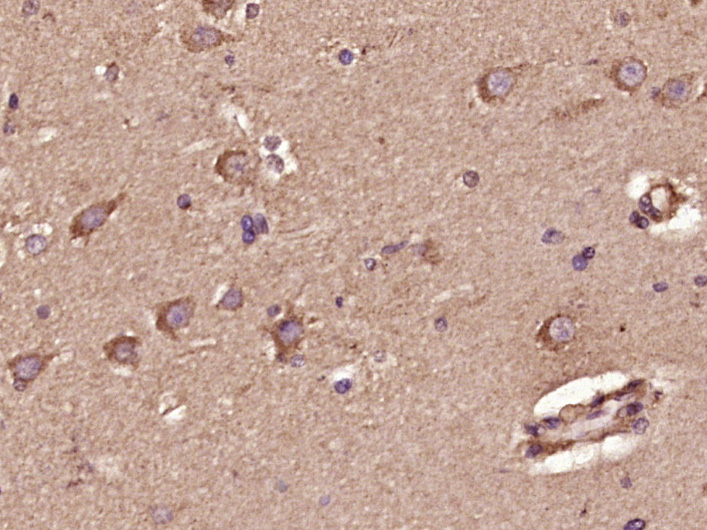 Ceramide glucosyltransferase R