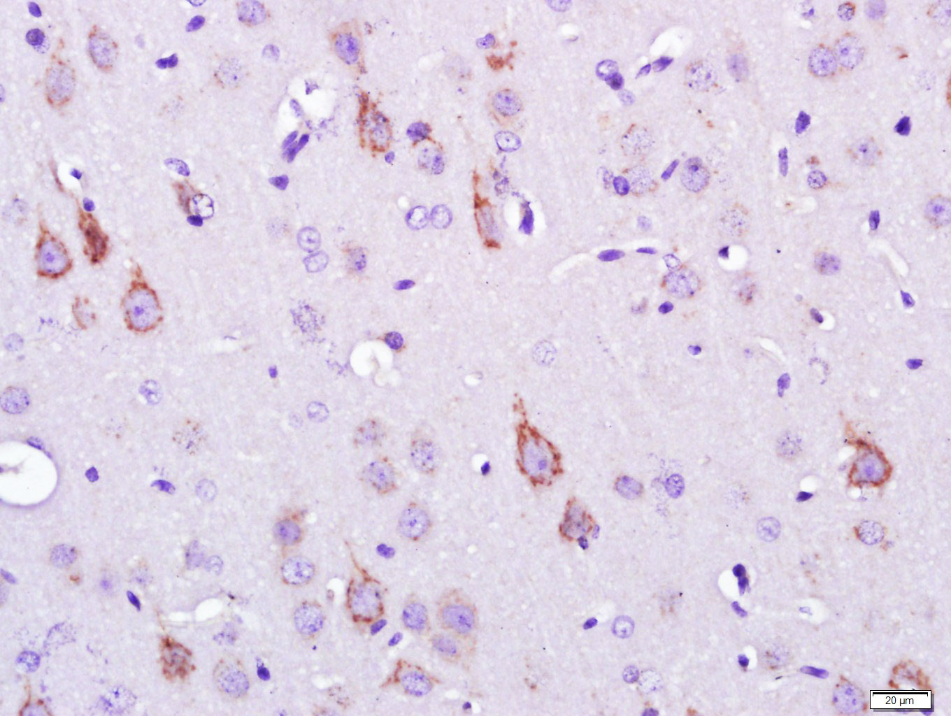 SEMA6D Rabbit pAb(bs-2943R)-50