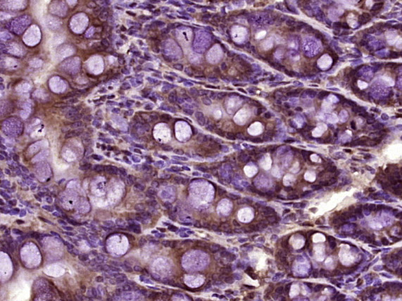 PSTK Rabbit pAb(bs-4419R)-50ul