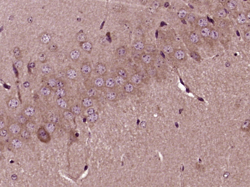 FTSJ1 Rabbit pAb(bs-12264R)-50