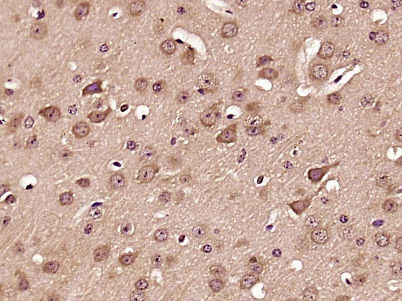 Synaptophysin Rabbit pAb(bs-88