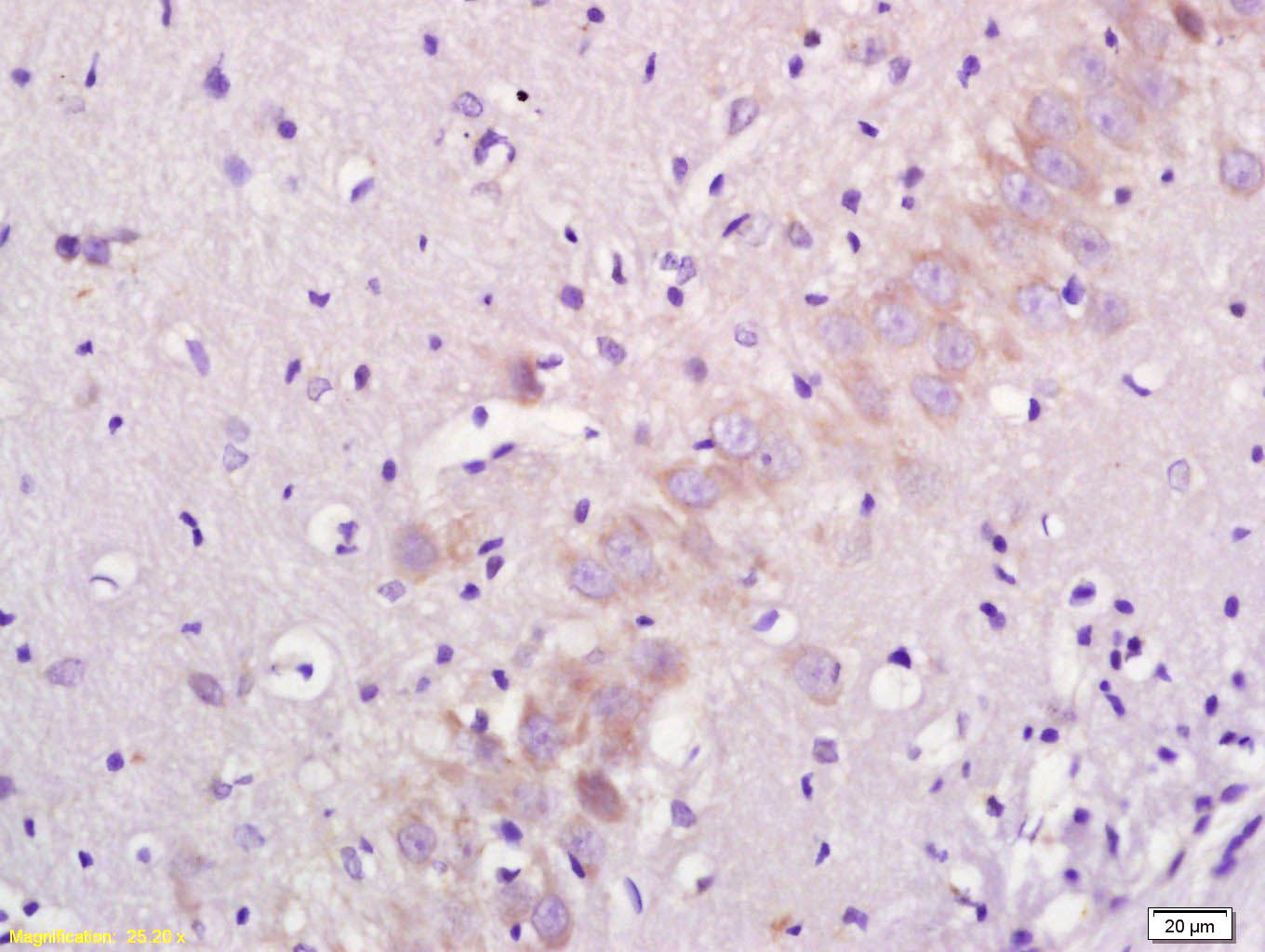 5HT2B Receptor Rabbit pAb(bs-1