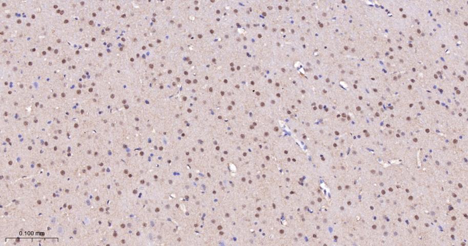 KDM4B Recombinant Rabbit mAb(b