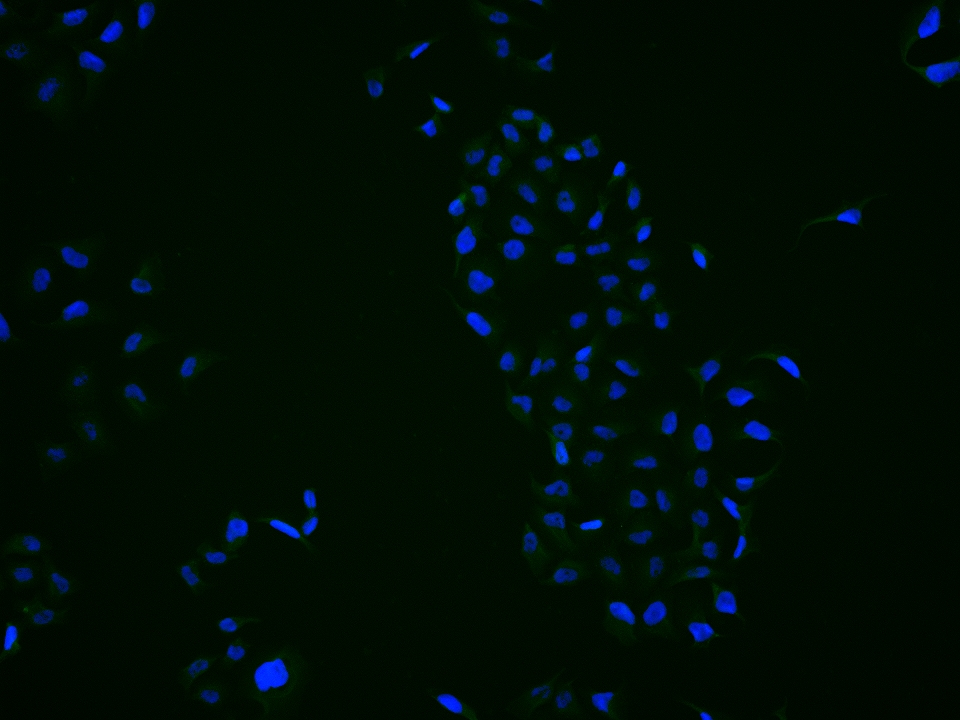 CBX4 Rabbit pAb(bs-17376R)-50u