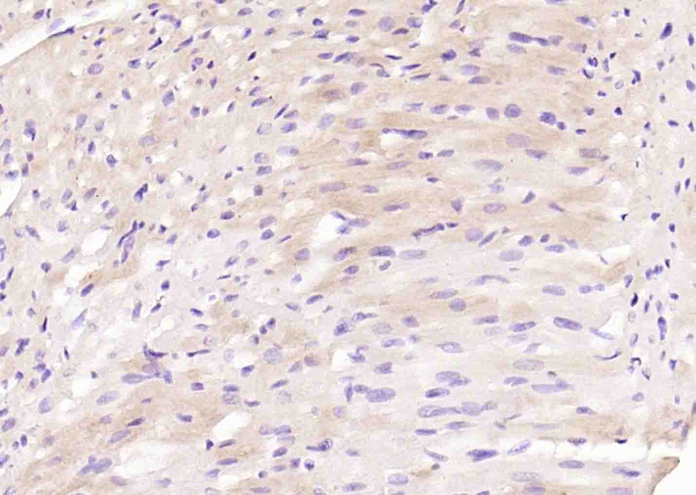 TMEM106B Rabbit pAb(bs-25543R)