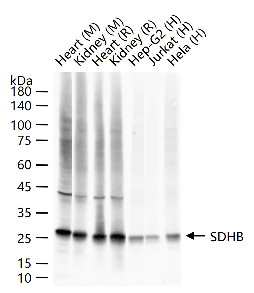 SDHB Recombinant Rabbit mAb(bs
