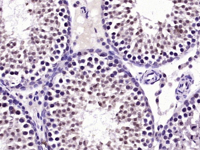 TKTL1 Rabbit pAb(bs-6284R)-50u