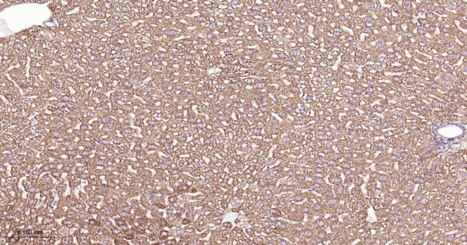 SDHB Recombinant Rabbit mAb(bs