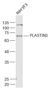 PLASTIN3 Rabbit pAb(bs-3643R)-