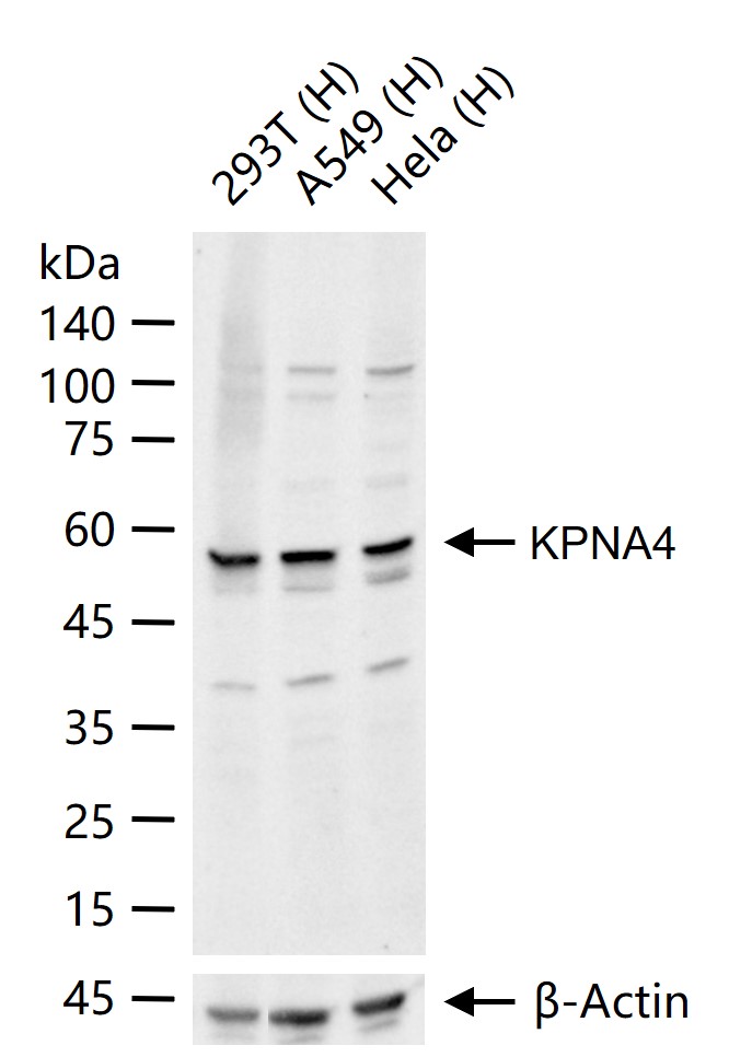 KPNA4 Rabbit pAb(bs-16804R)-50