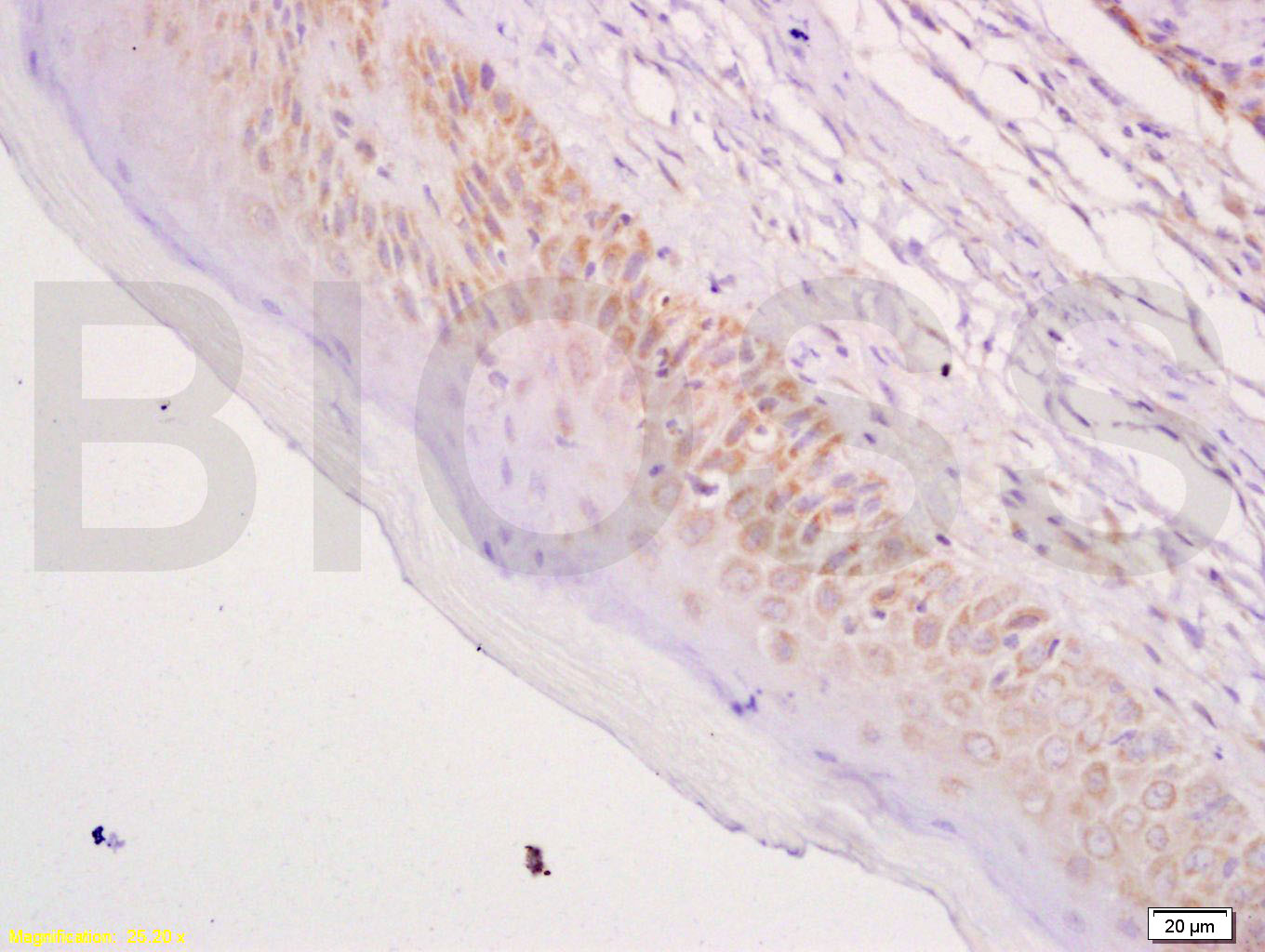 CK17 Rabbit pAb(bs-1431R)-50ul