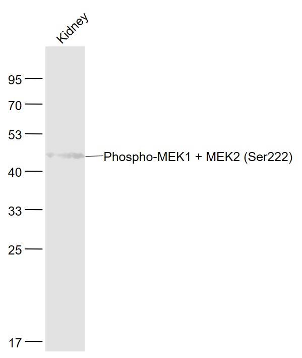 phospho-MEK1 + MEK2 (Ser222) R