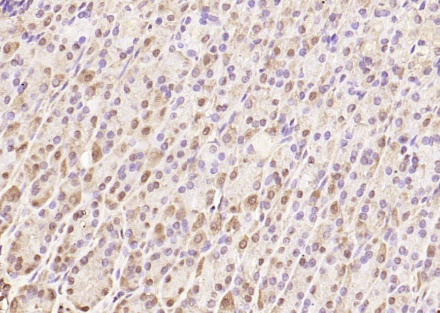 SQSTM1/P62 Rabbit pAb(bs-2951R