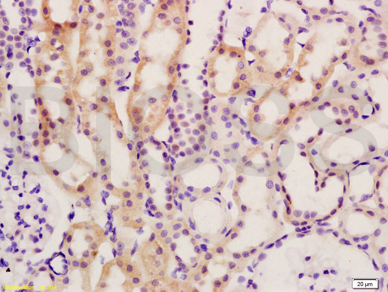 SMAD7 Rabbit pAb(bs-0566R)-50u