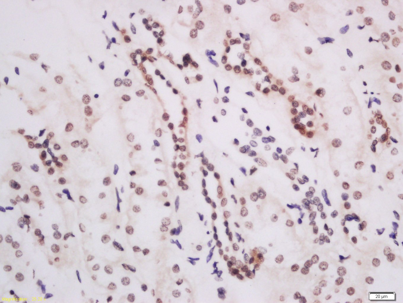 KMT4 Rabbit pAb(bs-16797R)-50u