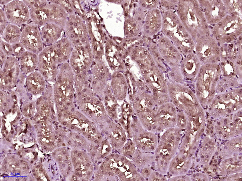 TNIK Rabbit pAb(bs-4168R)-50ul