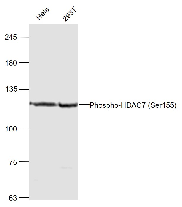 phospho-HDAC7 (Ser155) Rabbit 