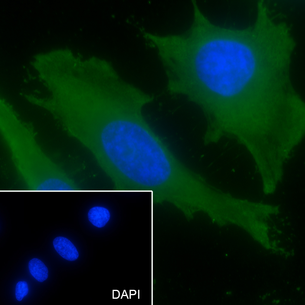 KIF20A Recombinant Mouse mAb(b
