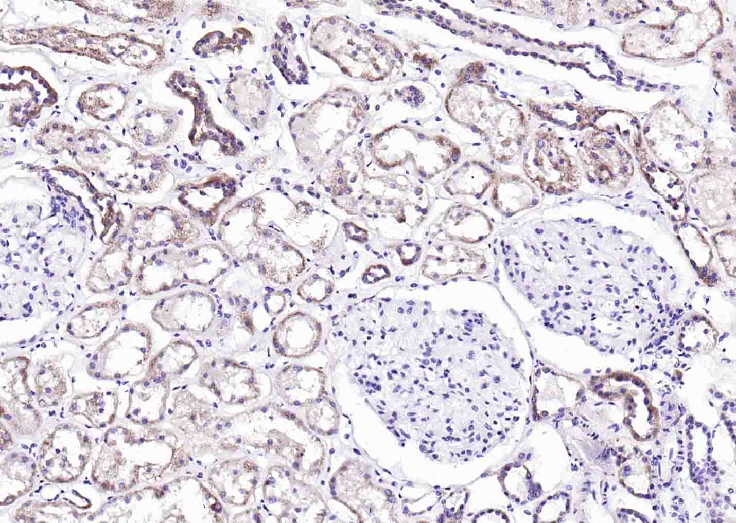 Artemin Rabbit pAb(bs-0055R)-5